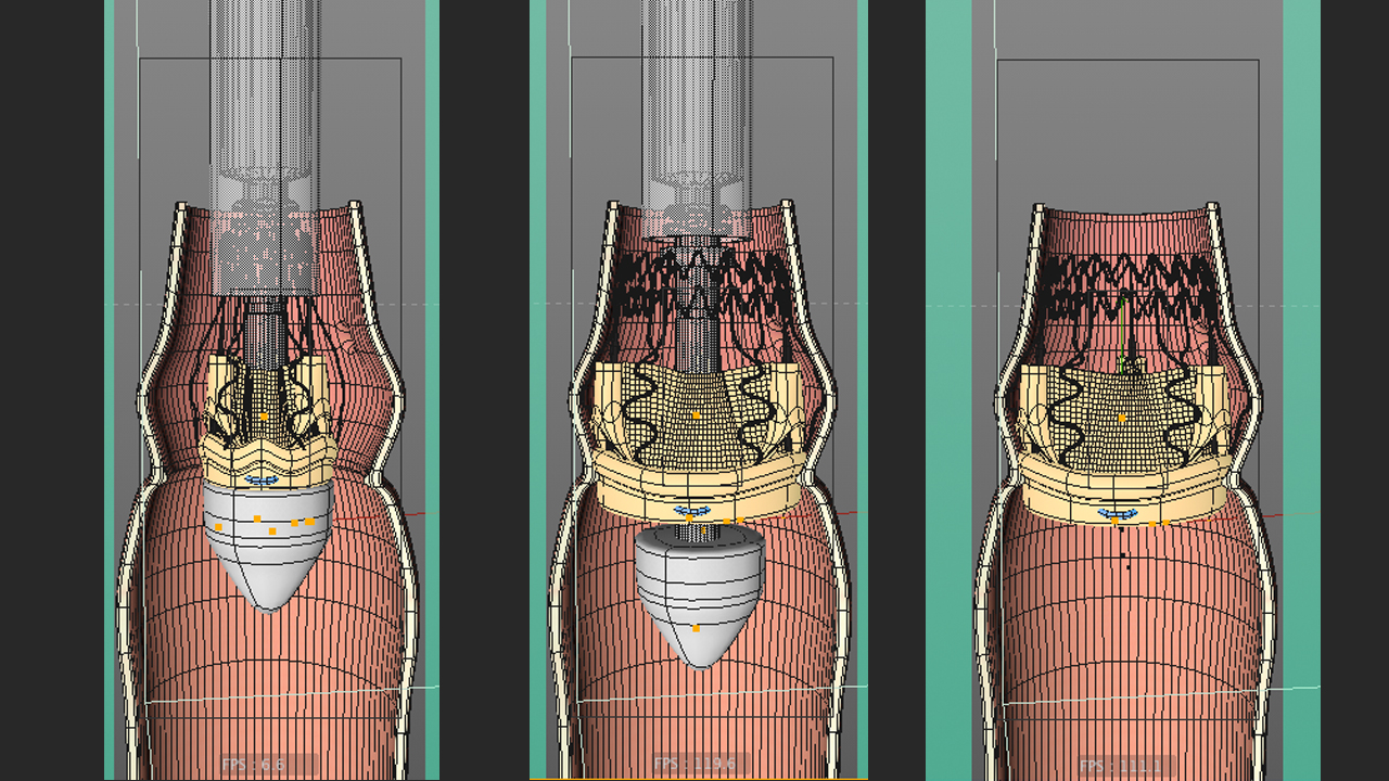 SORIN – Medical 3D